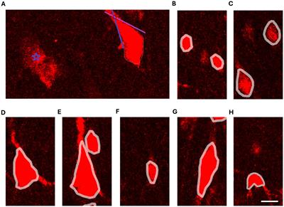 A novel approach to cytoarchitectonics: developing an objective framework for the morphological analysis of the cerebral cortex